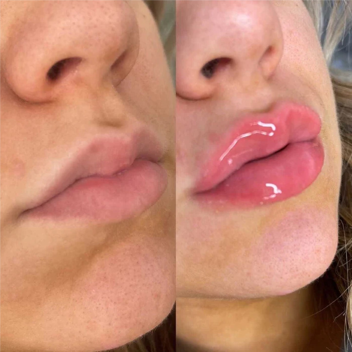 VOLULIPS Lip Plumper Efecto Inmediato