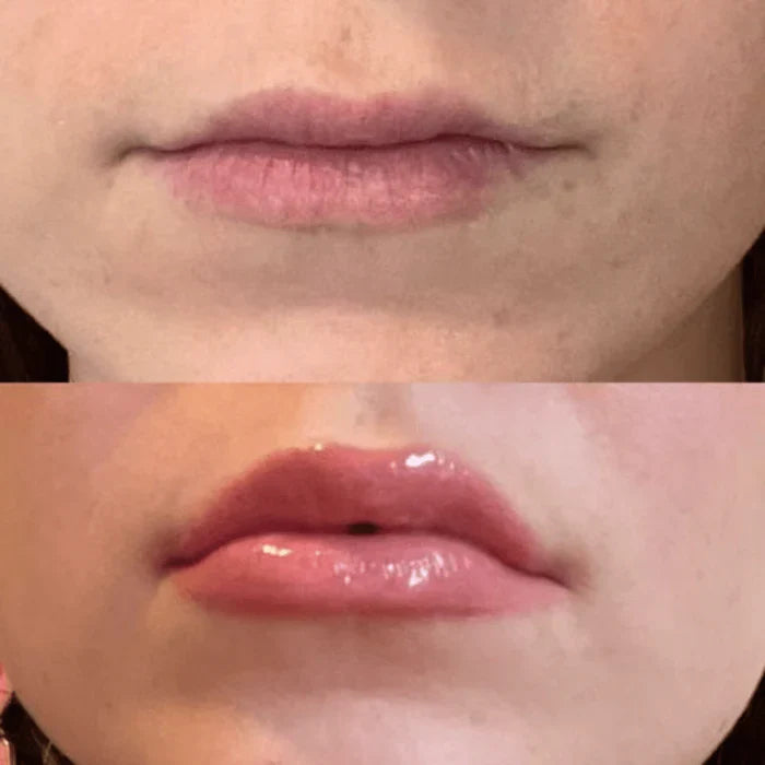 VOLULIPS Lip Plumper Efecto Inmediato